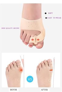 magnet toe corrector